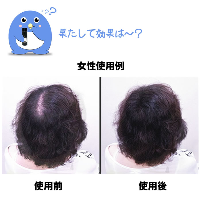 楽天市場】【公式】増毛パウダー シークレットプラス 50g 4点セット 4