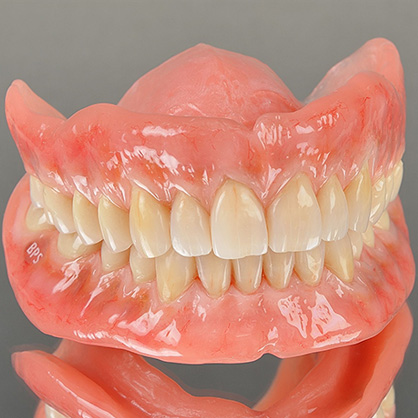 BPSデンチャーについて｜愛知県で精密義歯（BPSデンチャー）をご希望の方