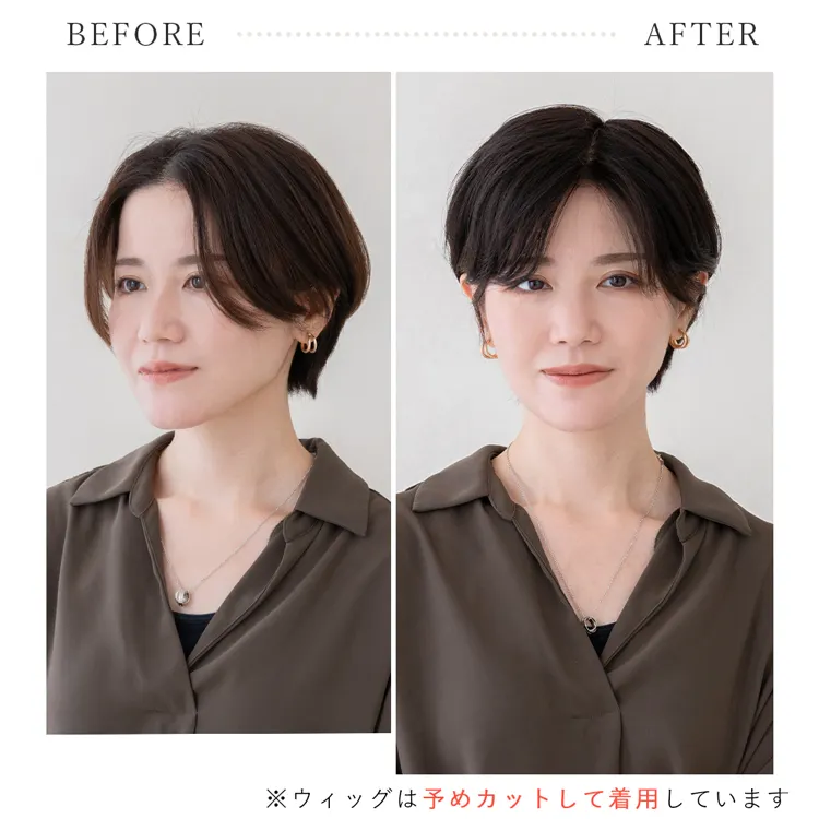 総手植え 最高級レミー人毛100% リアルフィットスキン トップ