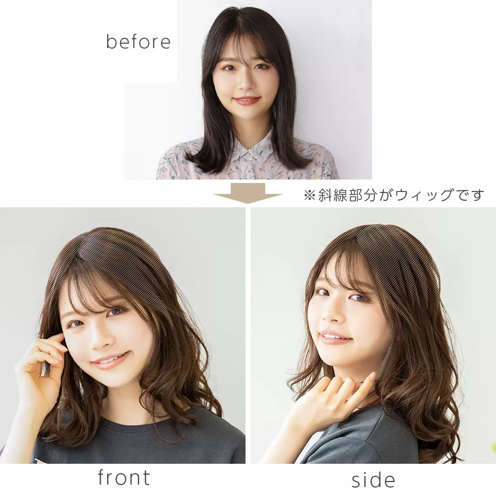 最高級人毛(レミー)100%トップヘアピース つむじタイプ（ポイント/医療