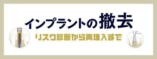 インプラントの撤去 ～リスク診断から再埋入まで～| 歯科総合出版社