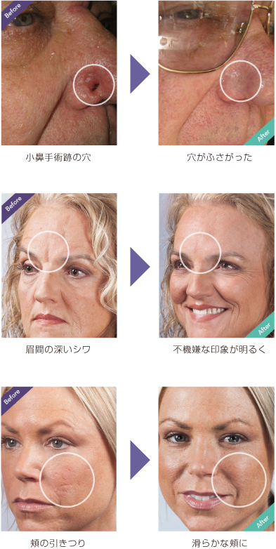 インスタント顔面補修メイク ダーマフラージ | 株式会社アイキャッチは