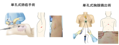 藤田医科大学岡崎医療センター 呼吸器外科