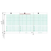 UPC-21L Lｻｲｽﾞｶﾗｰﾌﾟﾘﾝﾄﾊﾟｯｸ 200枚分/箱: エコー検査用品 - 医療Navi