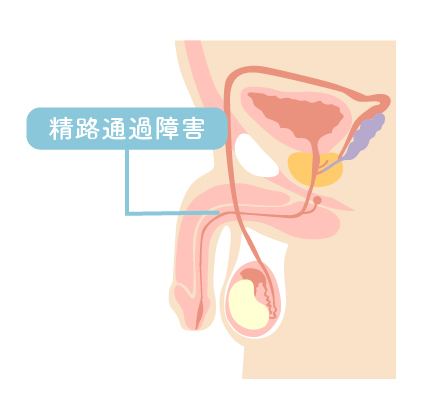 男性不妊｜はなおかIVFクリニック品川｜JR大崎駅徒歩90秒不妊治療