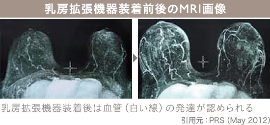 コンデンスビブラ豊胸｜THE CLINIC （ザクリニック）【公式】