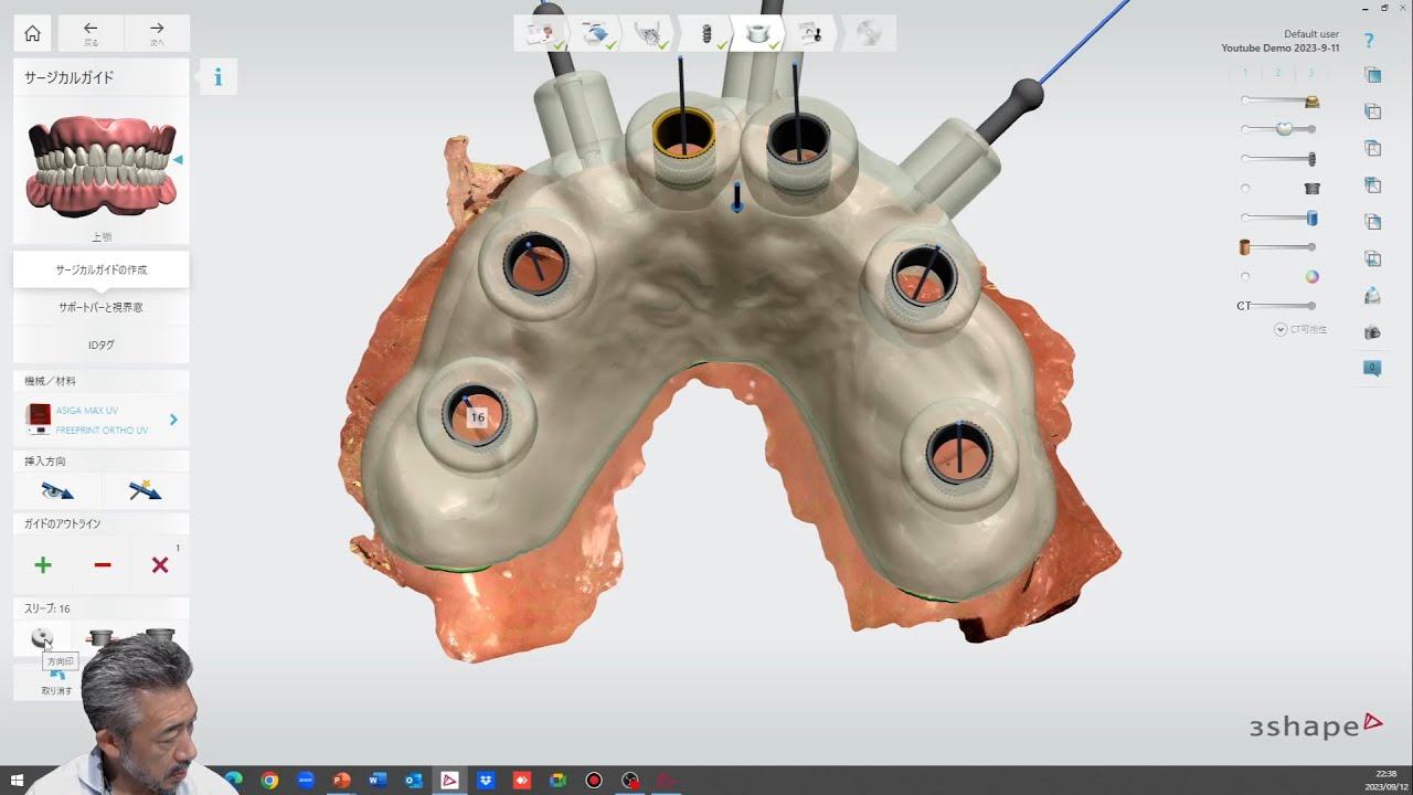 インプラントスタジオ実演シリーズ Part3 (無歯顎症例編) - YouTube