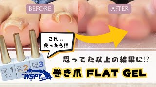 手軽に巻き爪ケアができるジェル！？検証しながらネイルチェンジします