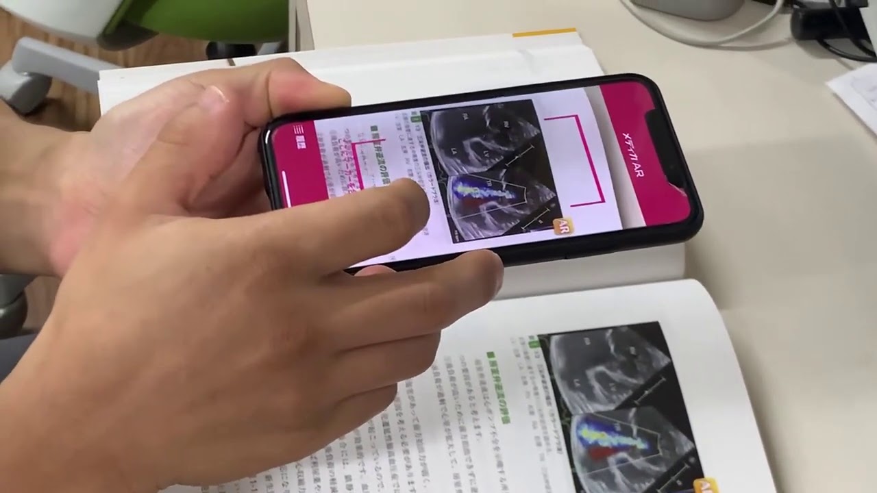 新生児の心エコー入門:超音波検査に基づくNICU循環管理のススメ - YouTube