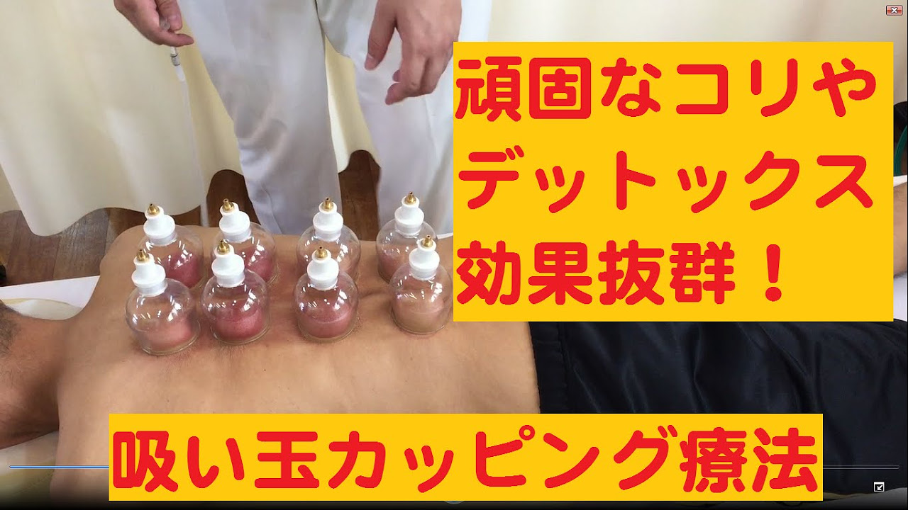 デトックス効果抜群！吸玉カッピング療法（火を使わず安全） - YouTube