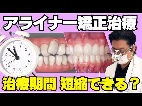 アライナー矯正治療の期間を短くするための工夫を解説します - YouTube