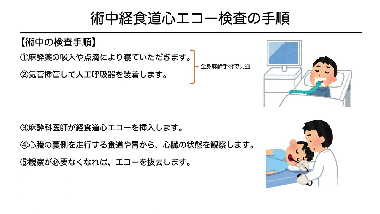 経食道心エコー・麻酔 説明動画 - YouTube