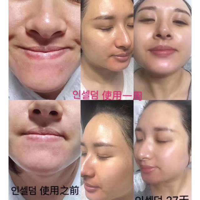 Incellderm インセルダム 3点セット 新品未開封 お買い得の通販 by と