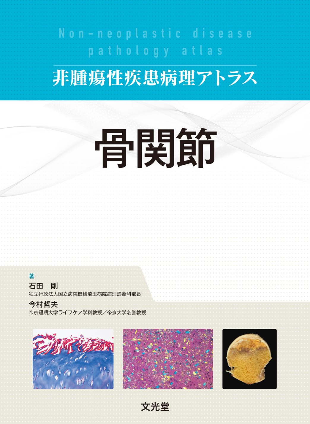 Amazon.co.jp: 非腫瘍性疾患病理アトラス 骨関節 : 石田 剛, 今村哲夫