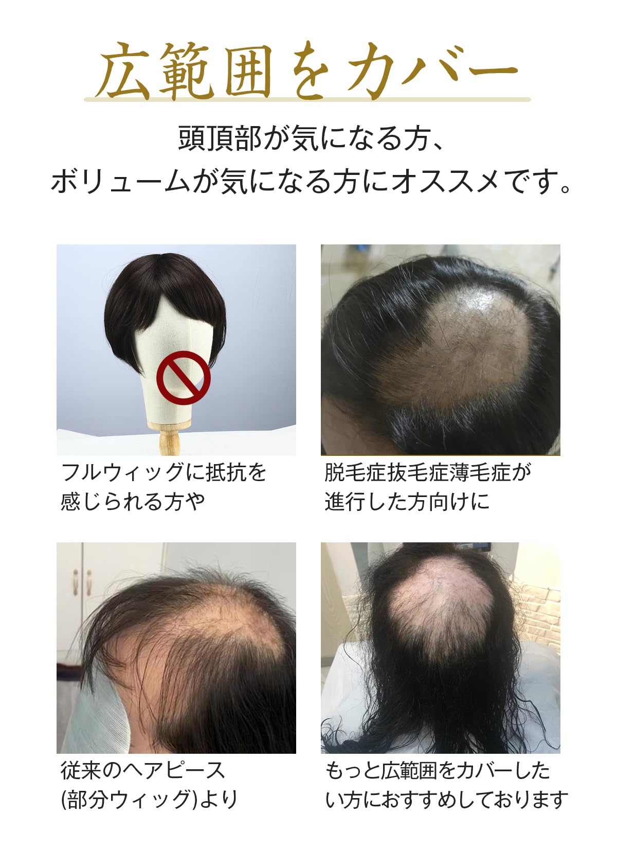 Amazon.co.jp: HIYE 部分ウィッグ 人毛100% 総手植え 広範囲 リアル