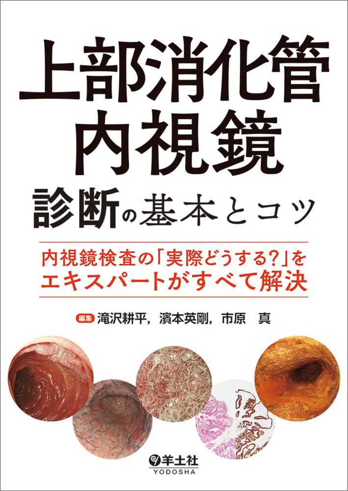 上部消化管内視鏡診断の基本とコツ〜内視鏡検査の「実際どうする？」を