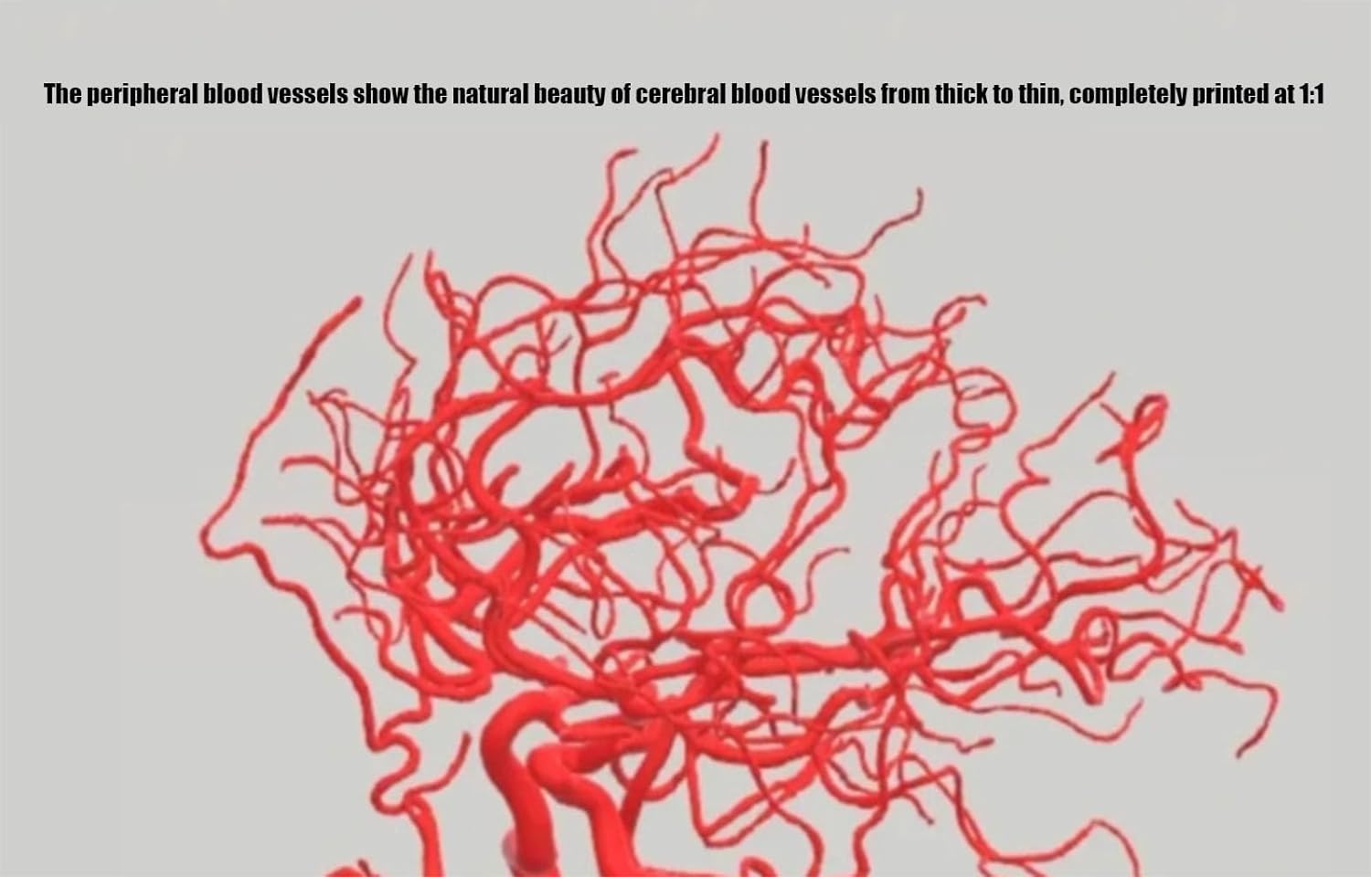 Amazon.co.jp: 3D頭頸部血管Mdel、30cm頭頸部動脈モデル高精度全脳血管