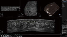 乳房用自動超音波画像診断装置（ABUS） - 大手町さくらクリニック in