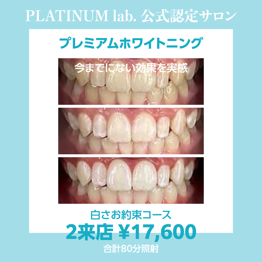 MENU | プラチナムビューティー鳥取店｜ホワイトニング・セルフ・白い歯