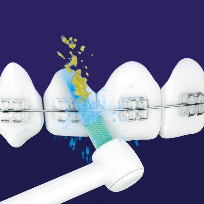 舌表面の汚れも洗浄できる「ジェットウォッシャー ドルツ EW-DJ74／EW