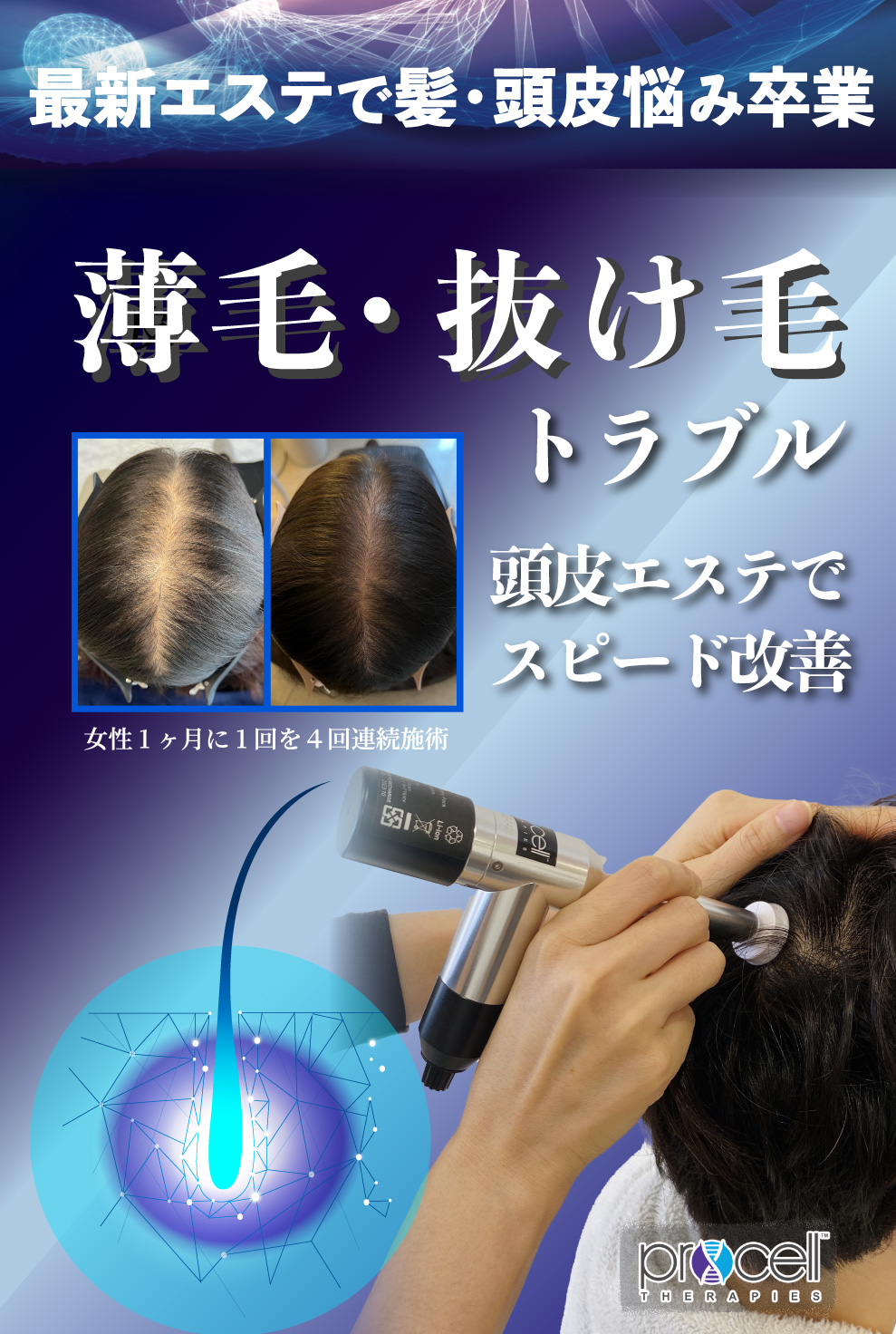 プロセルセラピーズ 頭皮をスピード改善し驚くほど元気にします