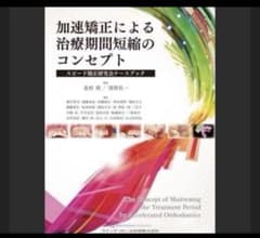 加速矯正による治療期間短縮のコンセプト = The concept of - メルカリ