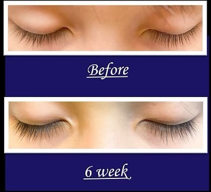 業界No.1まつ毛美容液！安全に伸びる！まつ毛美容液迷子の方おすすめ