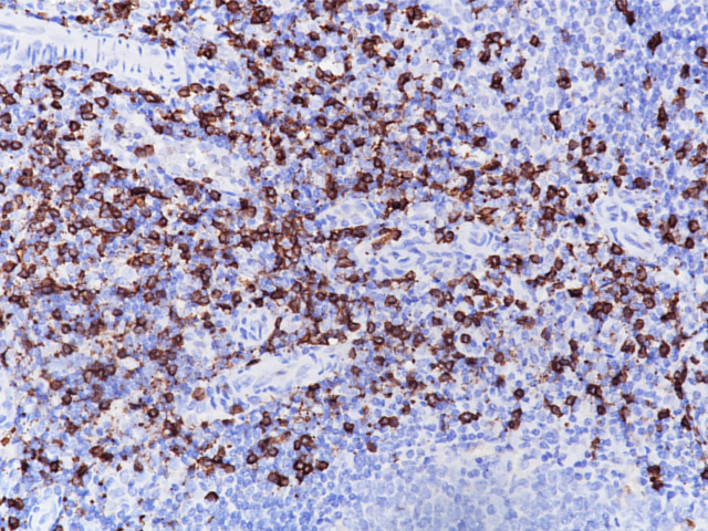 CD8 [C8/1779R] - Biocare Medical