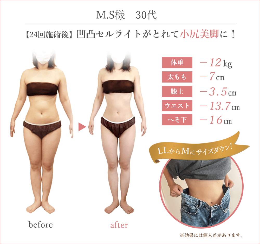 松戸市で人気の痩身エステサロン【BODYWORKS】｜骨盤矯正・痩身